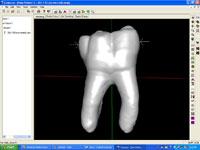 Tooth Explorer