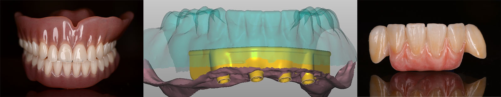 Prosthodontics