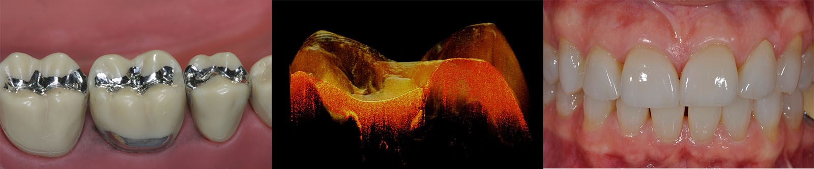 Operative Dentistry