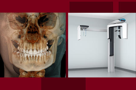 CBCT Technology