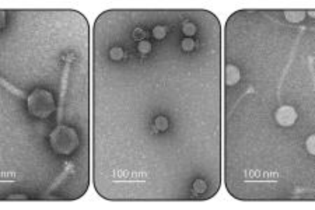 Electron micrographs of bacterial viruses, also known as phages