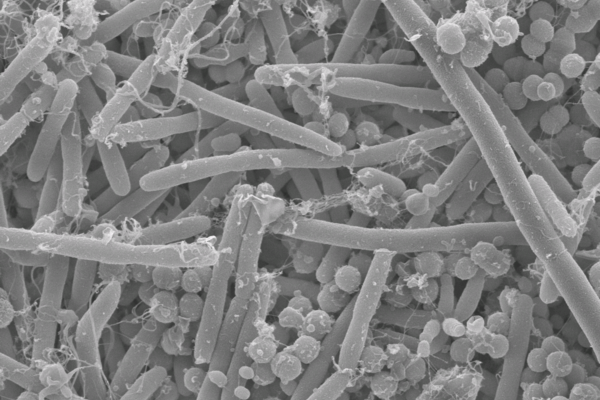 Biofilm on HA surfaces
