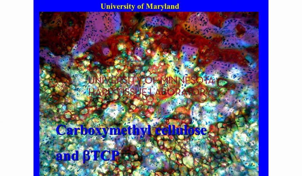 University of Maryland Carboxymethyl cellulose and BTCP