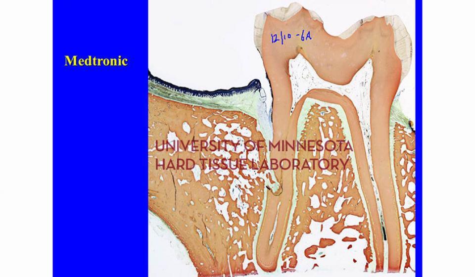 Medtronic