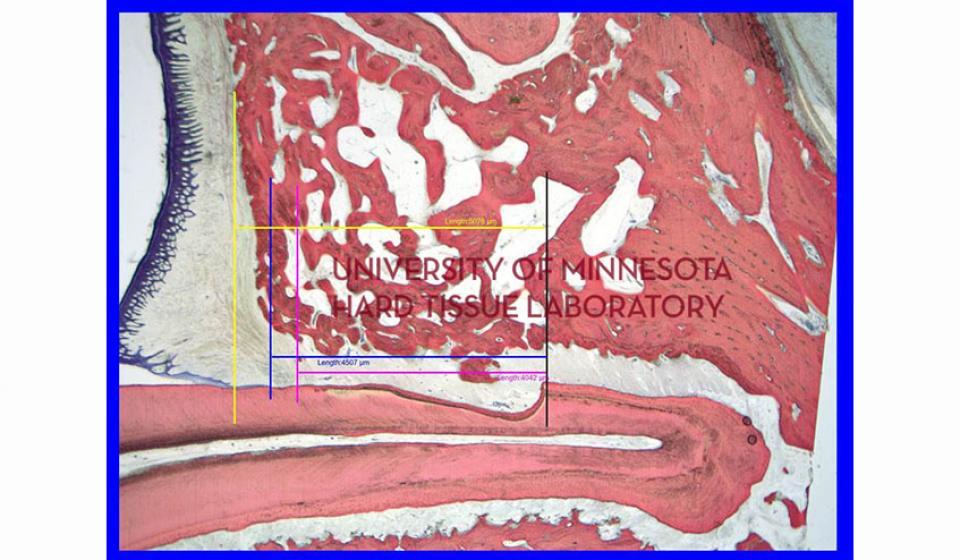 University of Minnesota Hard Tissue Laboratory