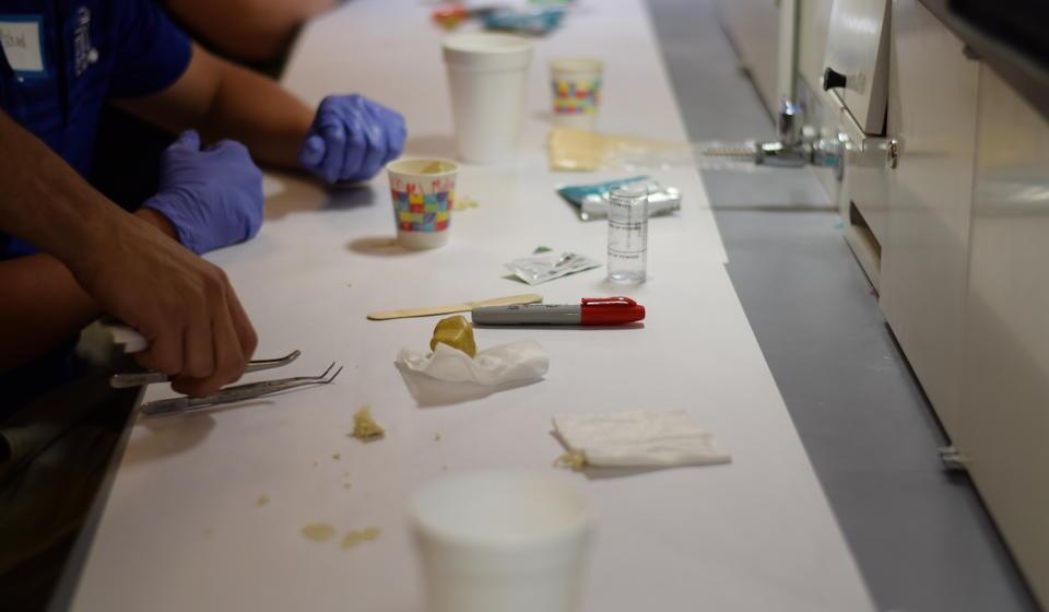 hands working with dental tools and models