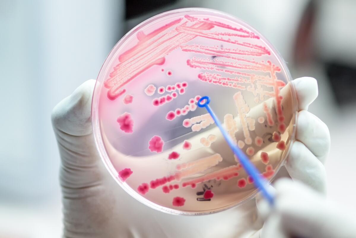 Microbe growth in a petri dish