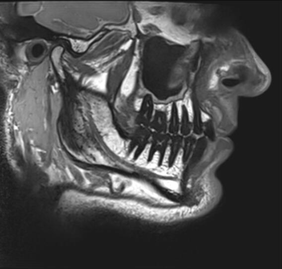 adjusted sagittal section of a newly-developed 3D proton density anatomy overview sequence