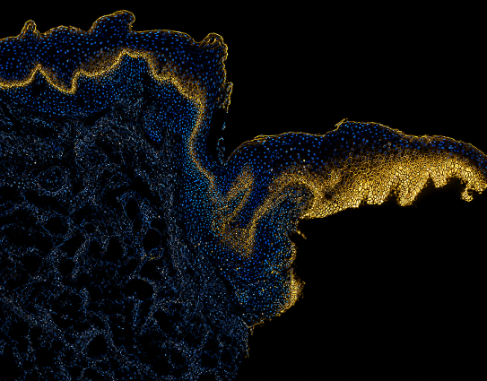  the staining pattern of the protein monocarboxylate transporter-1 (MCT1) across a human oral tissue section