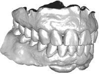 Virtual Dental Patient