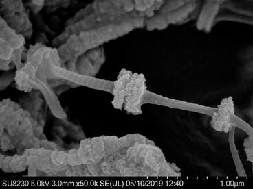 Biomineralization Hard Tissue Regeneration