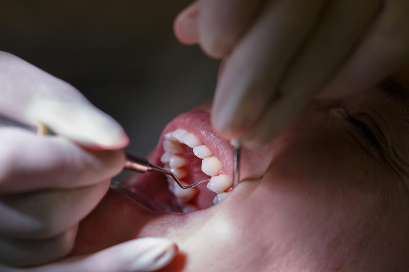 Advancing Your Staging and Grading Framework for Periodontitis and Peri-implant Disease