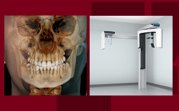 CBCT Technology