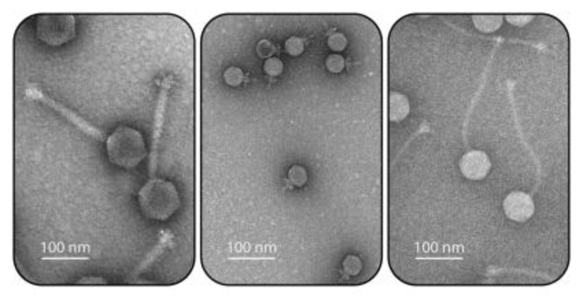 Electron micrographs of bacterial viruses, also known as phages