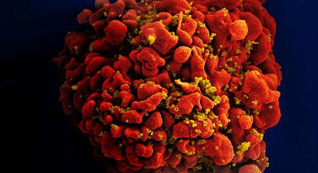 Mansky virus
