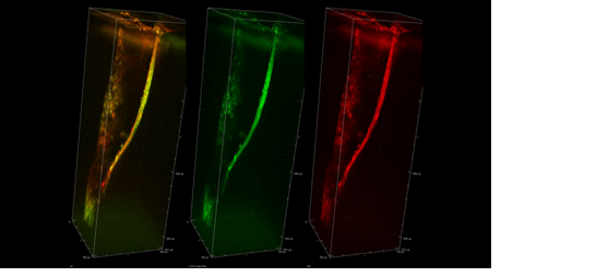 Bacteria  Biofilm on Antimicrobial Peptide Coasted Dentin Composite Interface